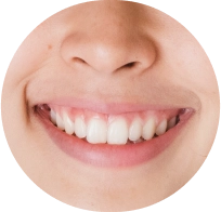 Smiles transformed