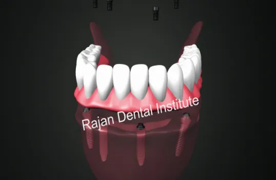 Rajan Dental