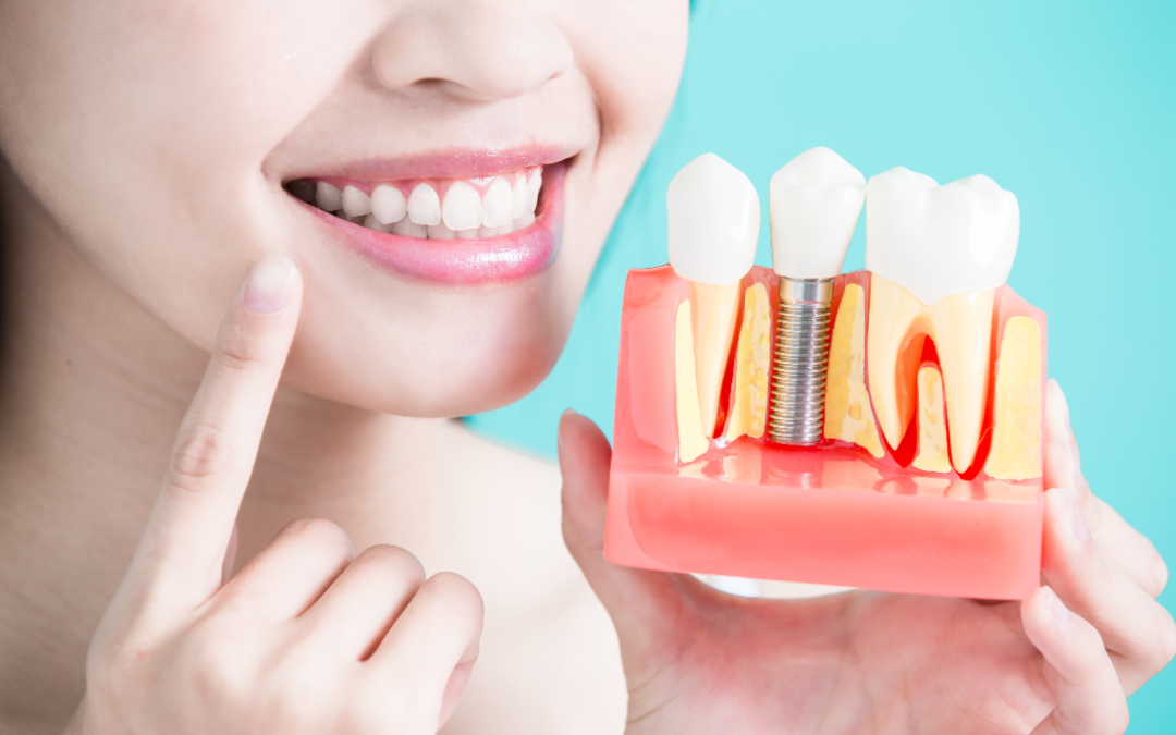 Wisdom Tooth Extraction: Procedure, Recovery, and Aftercare