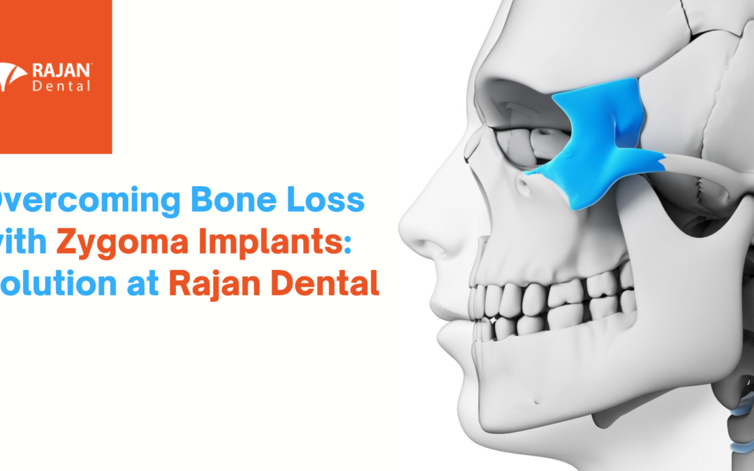 Overcoming Bone Loss with Zygoma Implants: Solution at Rajan Dental