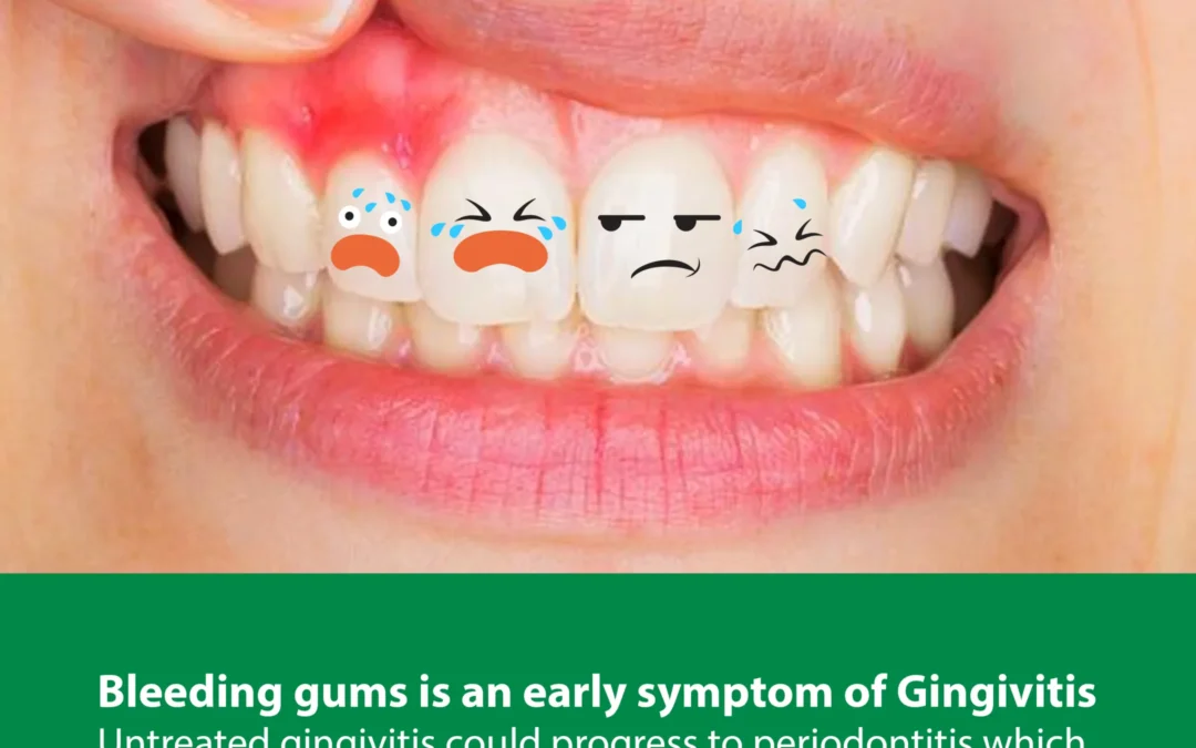 Oral Hygiene – Periodontics 1