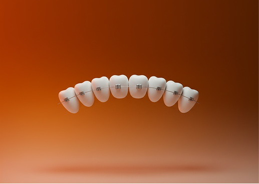 Orthodontic Treatment