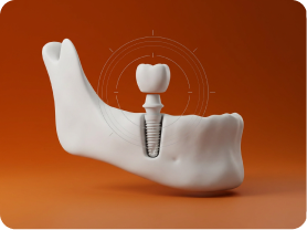 implantology