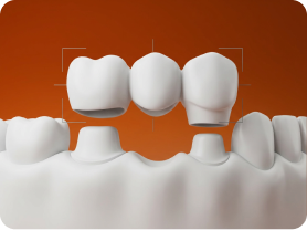 prosthodontics